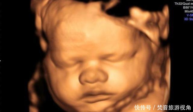 算数|“天才”胎儿走红,还在妈妈肚里就会“算数”,医生清华北大等你