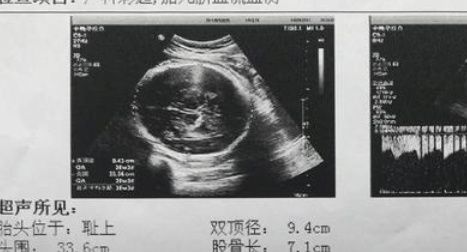 性别|孕妈有这3个“信号”，可能是小宝贝在告诉妈妈自己的“性别”！