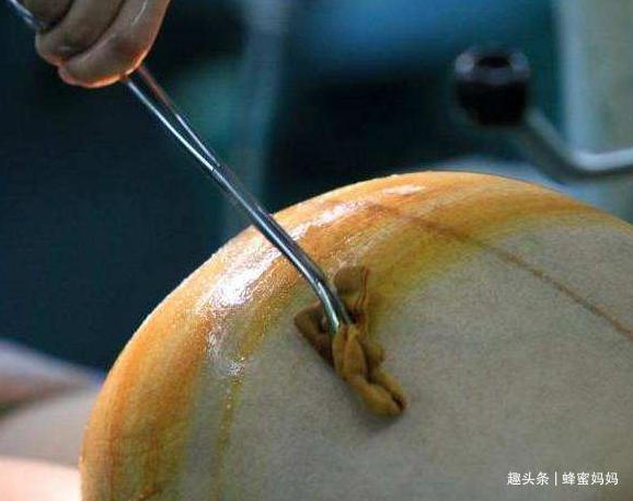 麻药|不打麻药“生剖”的剖腹产真实存在吗母爱的伟大,并非纸上谈兵