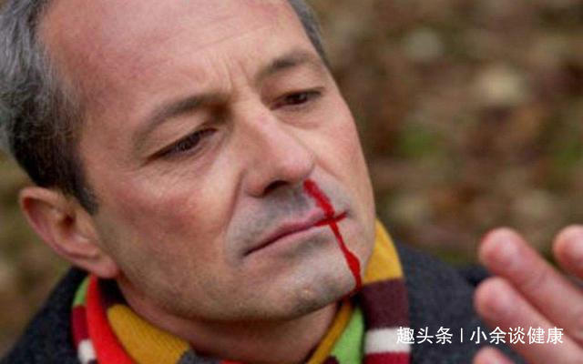 营养素|失眠是缺镁，脱发是缺锌，身体缺乏“营养素”的6种表现，你有吗