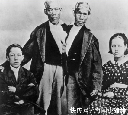 受精卵|连体哥哥爱上英国姑娘，弟弟每次只能回避，姑娘想一招三人都幸福