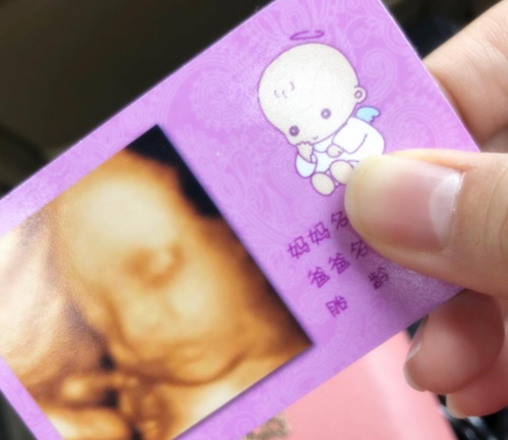 双份钱|做四维彩超后,不做这步相当于“白花钱”,在检查前孕妈要问明白