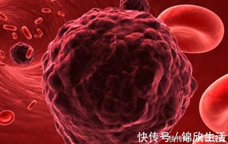 良性肿瘤|肿瘤手术后复发的几率是多少?做好4件事,或许有助降低复发率