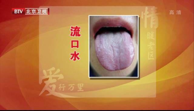 营养物质|吃不胖和瘦不了,可能都是“它”惹的祸!一次性告诉你