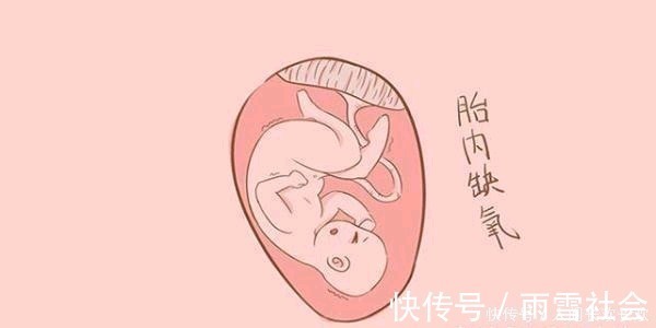 维生素c|孕妈出现这种症状,是贫血了,尽早发现才不会伤害胎儿