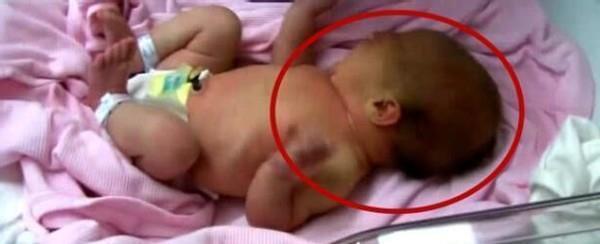 长辈|“机敏宝宝”火了,刚出生听到妈妈声音手舞足蹈,护士:头一回见