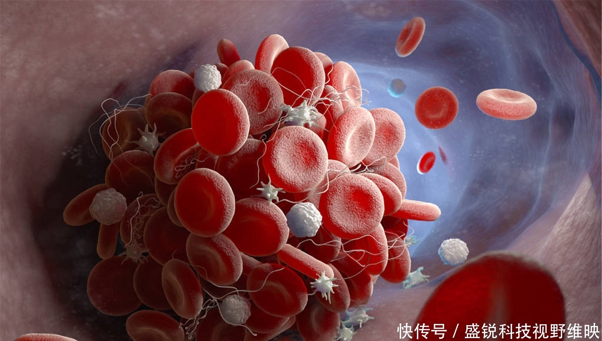 年轻|体内有血栓,睡觉时多半会有2个异象,多喝2水,保持血管年轻态