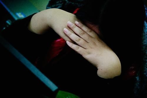 血压|血压多高可能引发脑出血?医生给出参考值,高血压患者需留意