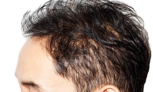 脱发|衰老来临前，身体会有6种表现，若不想衰老的过快，及时调理