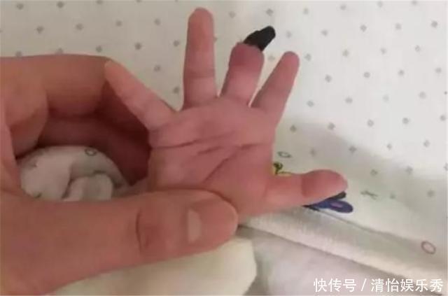 宝宝|6个月宝宝总哭闹,妈妈送医检查却被责骂,因宝妈太粗心害了孩子