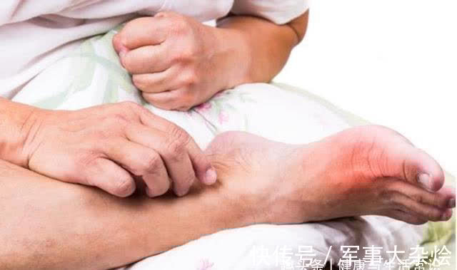 痛风|生花生和熟花生哪种更健康?提示:为了健康,5类人要谨慎吃花生