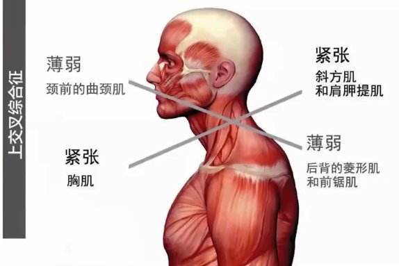 上交叉综合症|杭州美莱：怎么让你的背影比20+的女生还要纤薄挺拔？