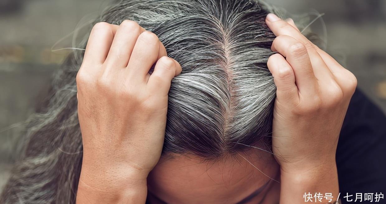 白头发可以拔吗?怎样能变回黑发?中医教你正确的白头发预防之道