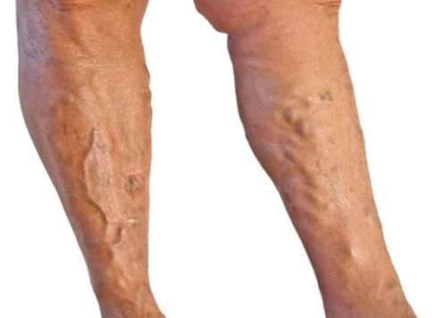 告诉你如何正确泡脚，因为养脚也是养生！