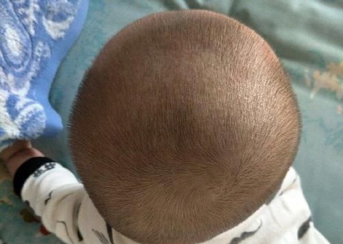 头型|婴儿头型形成的3个关键期,家长把握好及时纠正,错过就来不及了