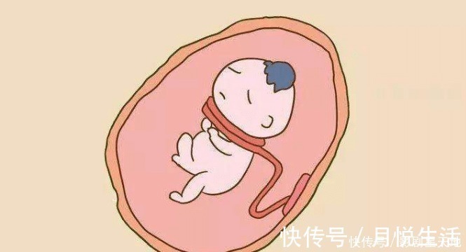 脐带绕颈|我们在怀孕期间的哪些行为会导致孩子出现脐带绕颈呢