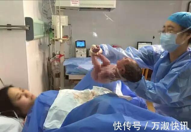 孕妇|27岁产妈生下龙凤胎，刚要缝合时突然喊“等一下”，医生都愣住了