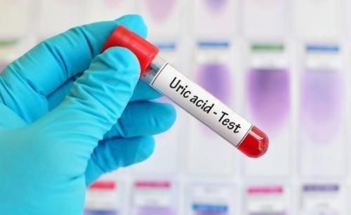 专家再三提醒：此2物“水嘌呤”不高，但“痛风患者”要少喝！