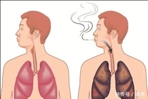 吸烟|长期吸烟的人,多吃点尼古丁的“天敌”,清烟毒,肺部更健康