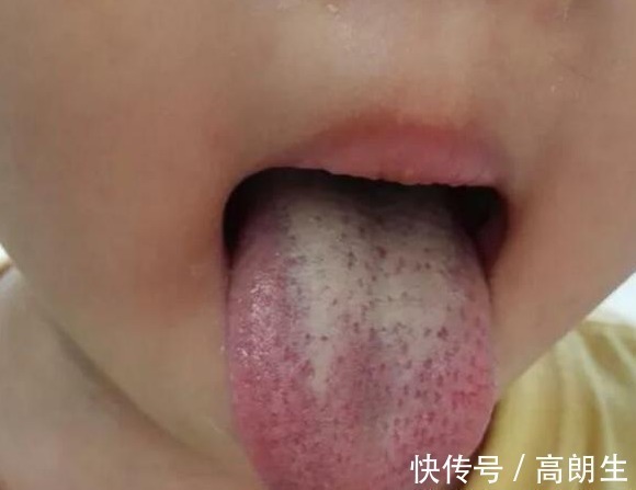 平衡机体|10岁男童一年长高21公分,儿科主任坚持这好习惯,长个不犯愁