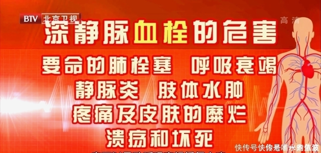 血流|脚上有个化血栓开关,打开它,清血管、防血栓!9种人最好常做!