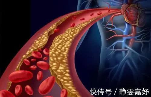 康复|恶性肿瘤是如何扩散的日常预防很重要,早发现,早康复。