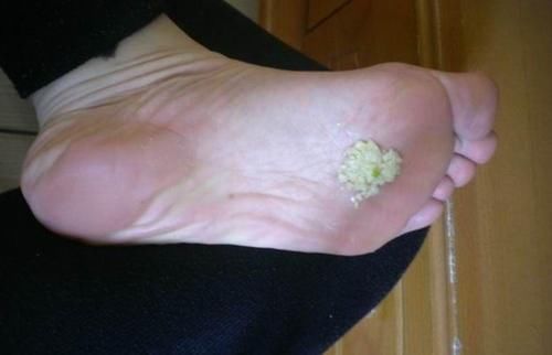 生活中常吃的大蒜，还有以下3种妙用，看看你见识过吗？