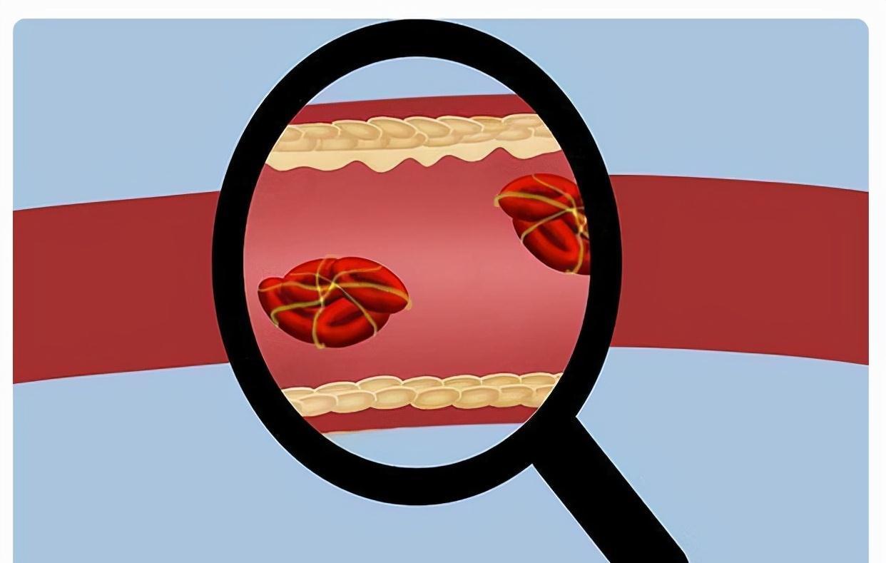 大脑|头晕耳鸣，是大脑供血不足？多吃3种食物，或改善大脑功能