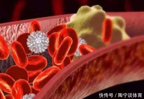 高血脂症|建议中老年，若不缺钱多吃这2物，稳血脂通血管，还不贵