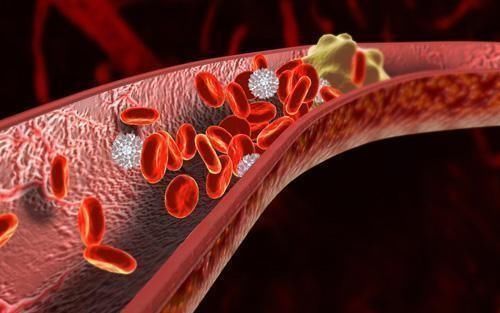 脂质|56岁大姐天天吃素,却得高血脂,医生直言:再吃下去或离脑梗不远