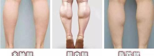 女生|建议“腿粗”女生，分清肌肉腿和水肿腿再坚持这样做，想不瘦都难