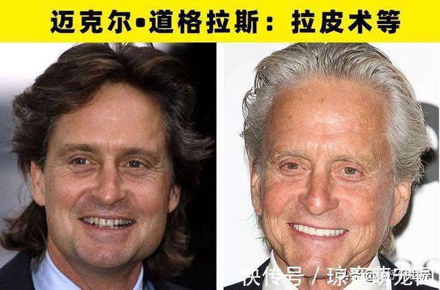 手术|大方承认自己做过整形手术的8名好莱坞明星