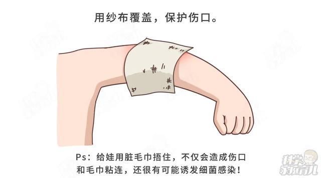 伤口|偏方治烫伤,6月娃不幸离世!孩子烫伤后,牢记5个字,能救命
