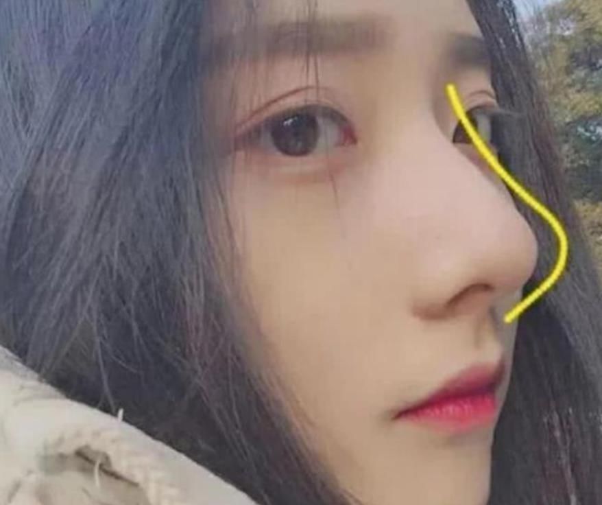 黑头粉刺|最“毁鼻子”的3行为,学生党却养成习惯,占一个异性缘归0哟!