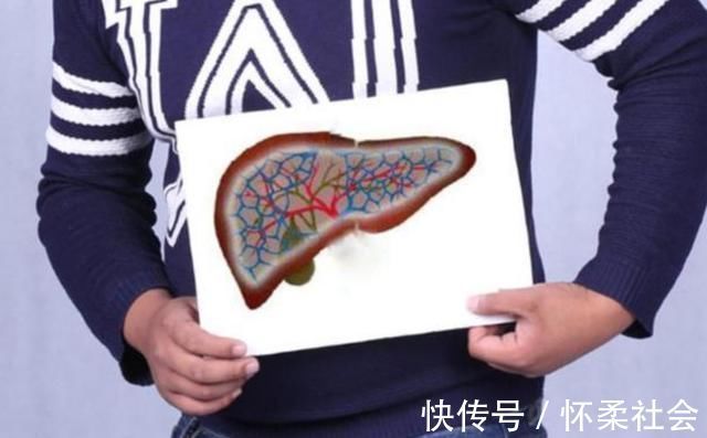 优质蛋白|肝脏比较喜欢的三种水果,若经常吃,肝脏或会感激你