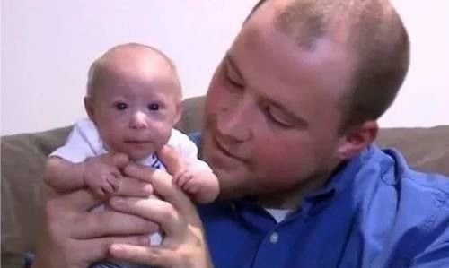 侏儒症|婴儿刚出生就被判侏儒症停止发育，父母不愿放弃如今变成这样！