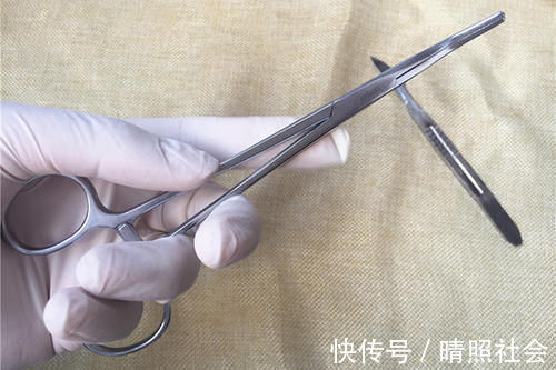 甲状腺结节|体检查出的结节、增生和息肉，哪些会癌变，哪些不要治？