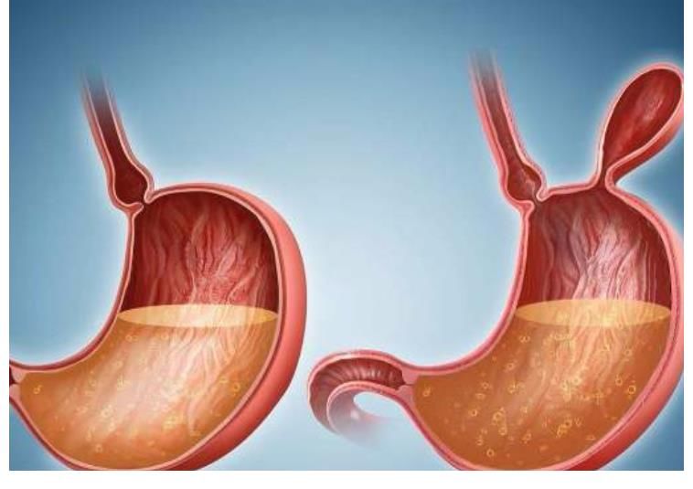 血液循环|76岁消化科中医提醒：做好3件事，有助于降低患胃病的风险
