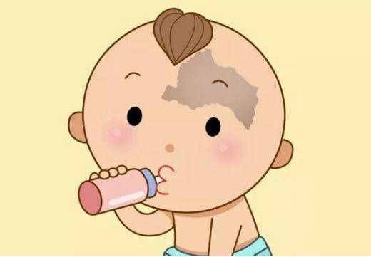 专家|济南童康胎记专家教你:怎么判断宝宝身上的胎记属于哪一种?