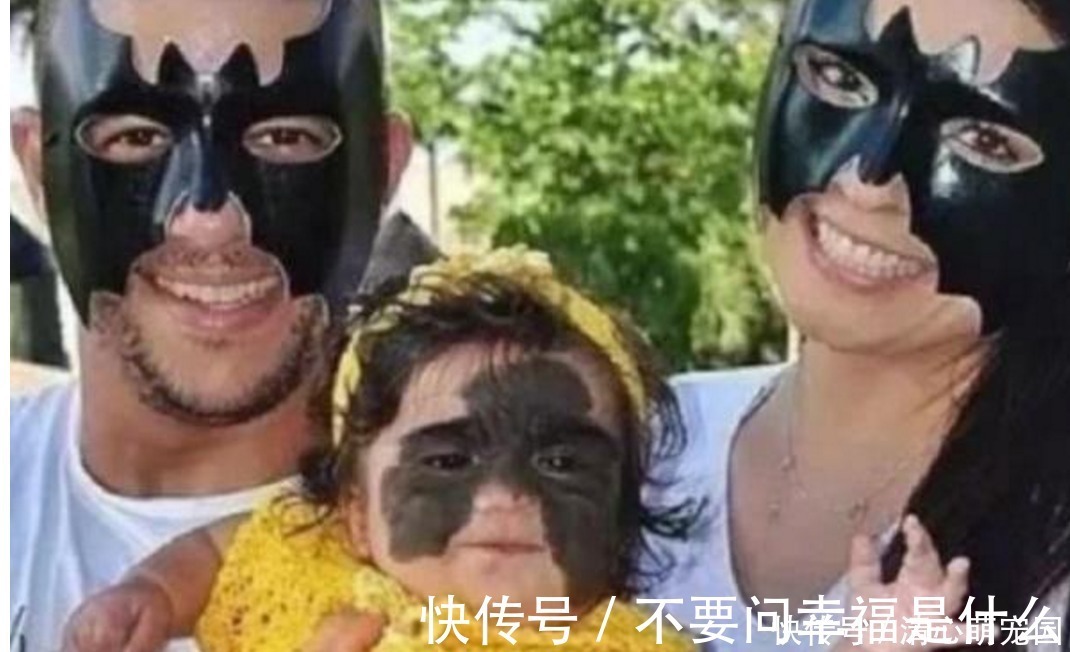 整容|女婴一出生伴随“蝙蝠侠印记”,被父母送去整容7次,结果怎样了