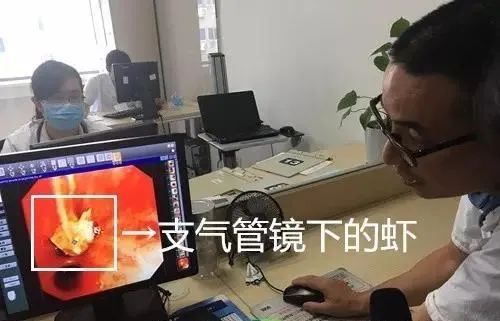 支气管|消失的假牙钩在气管上,杭州大伯“心肺都要咳出来”!这些动作不要再做了!