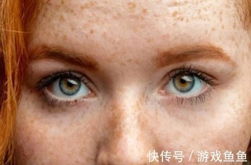 眼部|面部出现3种异常，说明血脂偏高，养成3个好习惯，或利于血脂稳定