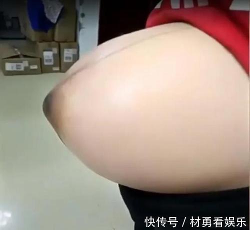 皮肤|孕妈晒“悬浮肚”走红，人人说是双胞胎，孕妈遭遇让人心疼又担心