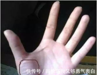 青筋|手掌上这块肉，一看就知道身体好不好！没事经常搓一搓，宣肺强心