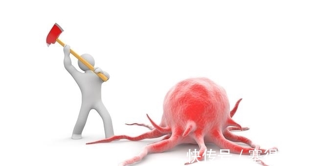 癌症|肿瘤切除后,为何还复发?肿瘤专家一席话,胜过自己摸索5年