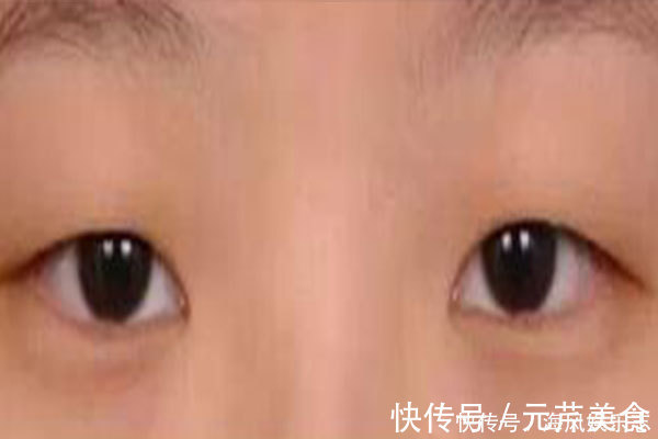 脸上有张“疾病地图”,哪里生病了,它会“告诉你”,快对照自检