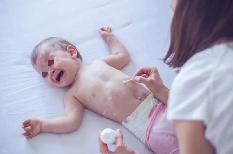 传染病|罹患这种病也须隔离!进入高发季,专家喊孩子们接种疫苗