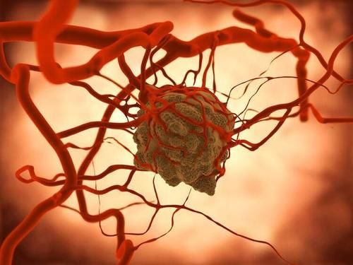 对症治疗|癌症并不是“突然发生”？提醒：身体4处不适，及时检查或有帮助