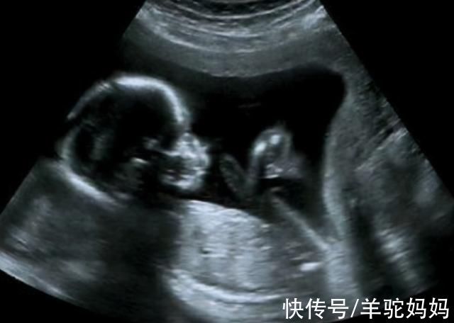 胎心|孕期若宝妈出现这3种表现,恭喜你,多半是怀了“男宝宝”