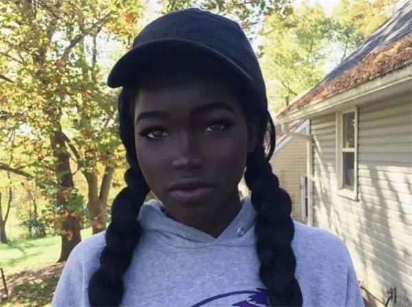 她是“最美黑人女孩”,因长得太漂亮,家人从不敢让她单独外出